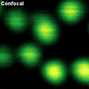 Confocal